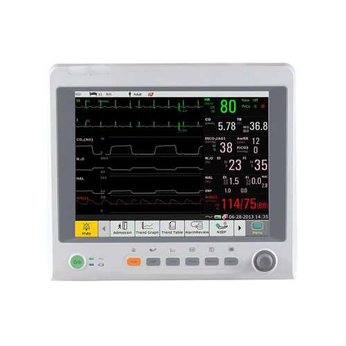 Srdeční monitor Edan iM70 VET od společnosti Masimo Mainstream AG Edan-iM70.pngKardiomonitor Edan iM70 VET z Masimo Mainstream AG – ekran dotykowy, cicha praca, kapnografia, EKG, SpO₂, NIBP i monitoring parametrów u zwierząt.