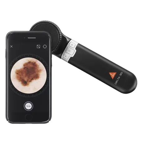 Dermatoskop DELTA 30 Delta30_iphone.webp